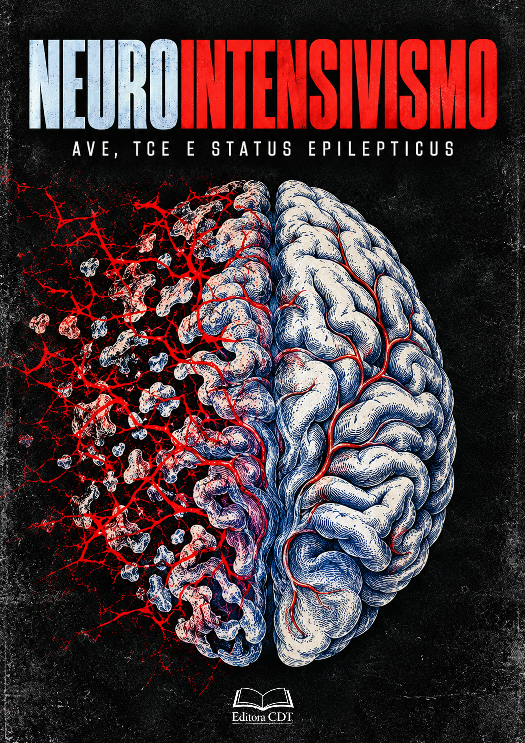 Neurointensivismo — AVE, TCE e status epilepticus
